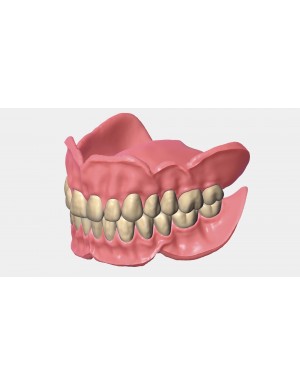 EXOCAD Software Full Denture Module